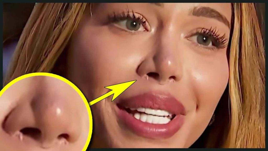 Носът на Анна Шермин