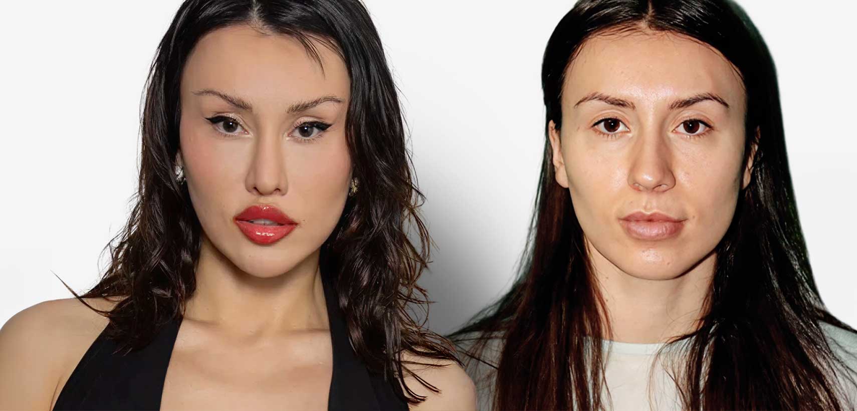 Санта Китана преди и след операциите си